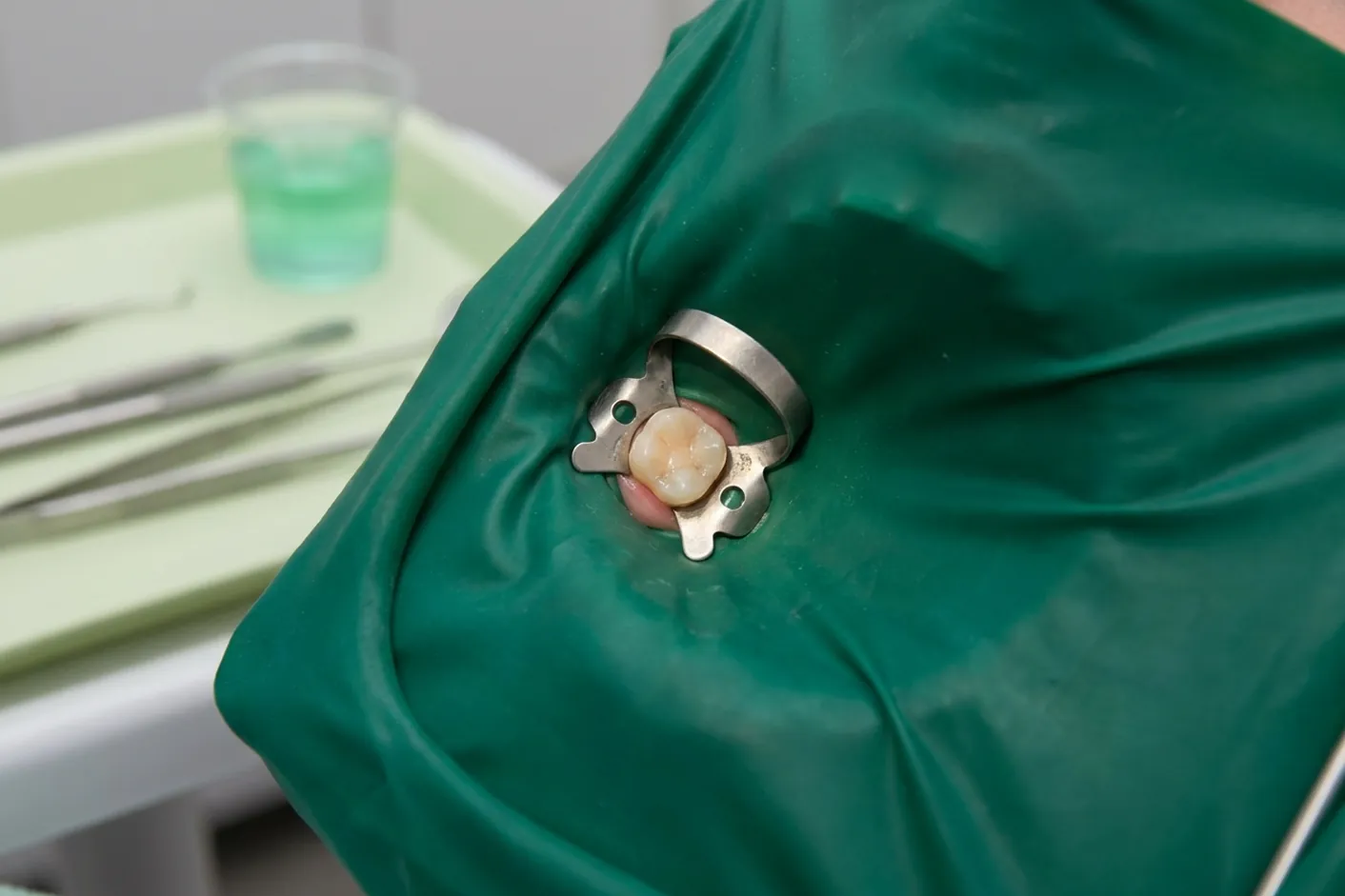 Render clinico della diga di gomma: il dente isolato dal foglio teal