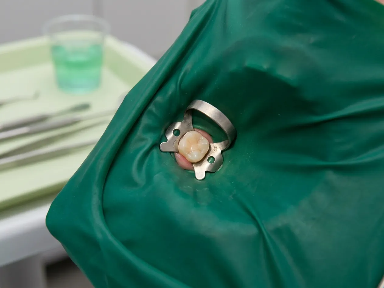 Render clinico della diga di gomma: il dente isolato dal foglio teal
